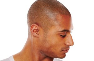 effective-hair-loss-solutions-for-men