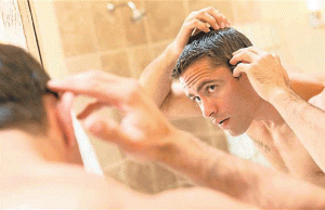 men-hair-loss-treatment